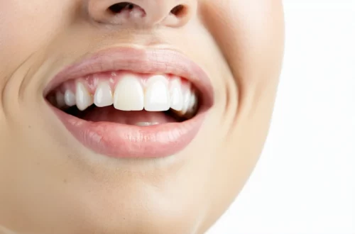 Que faire quand une dent de sagesse pousse enceinte ?